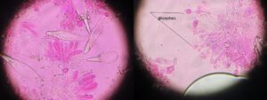Cours de mycologie : nouvelle session